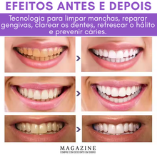 Carregar imagem no visualizador da galeria, BrightSmile® - Clareador, Limpeza, Remoção de Tártaros e Melhora do hálito.
