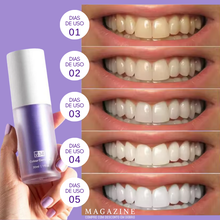 Carregar imagem no visualizador da galeria, BrightSmile® - Clareador, Limpeza, Remoção de Tártaros e Melhora do hálito.
